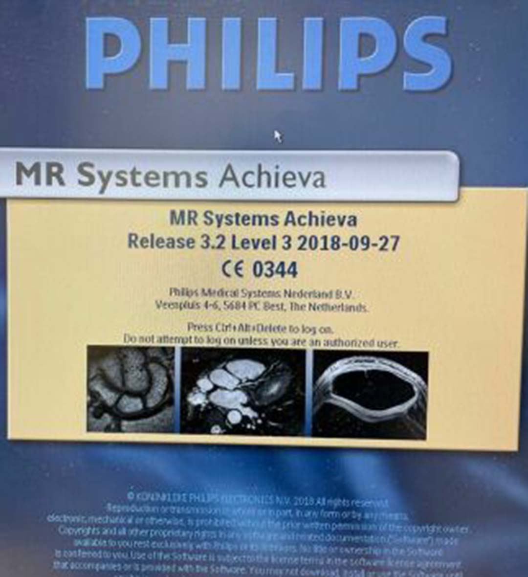 2005 Philips Achieva 1.5T MRI System
